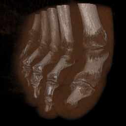 foot.jpg