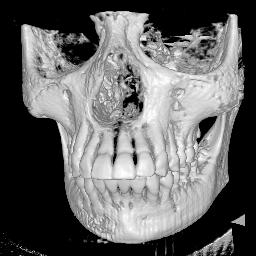 skull.jpg